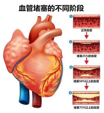 新一年的健康体检，你真的做对了吗？(图5)