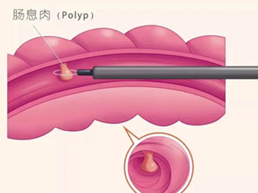 【健康科普】早发现三个月，多活三十年，还有比这更开心的吗？(图3)